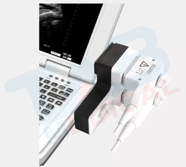 DW-500 B/W Ultrasound - Image 2
