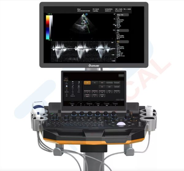 DW-T60 High Color Doppler Ultrasound - Image 3