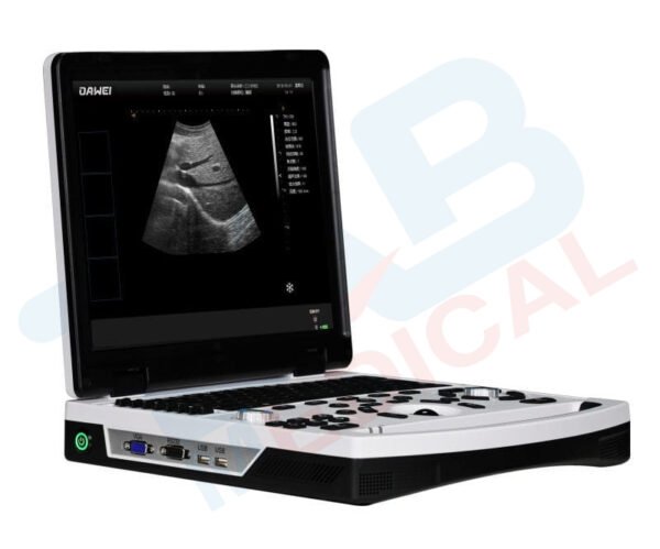 DW-690 Portable B/W Ultrasound - Image 4