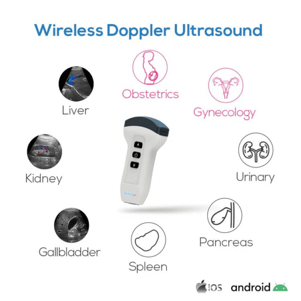 Wireless Handheld Ultrasound Probe - Image 2