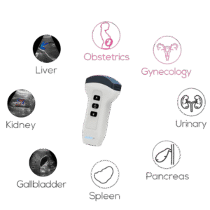 Wireless Handheld Ultrasound Probe