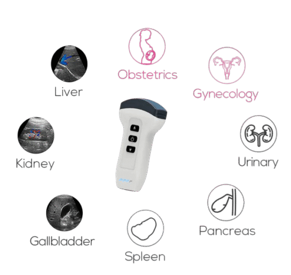 Wireless Handheld Ultrasound Probe